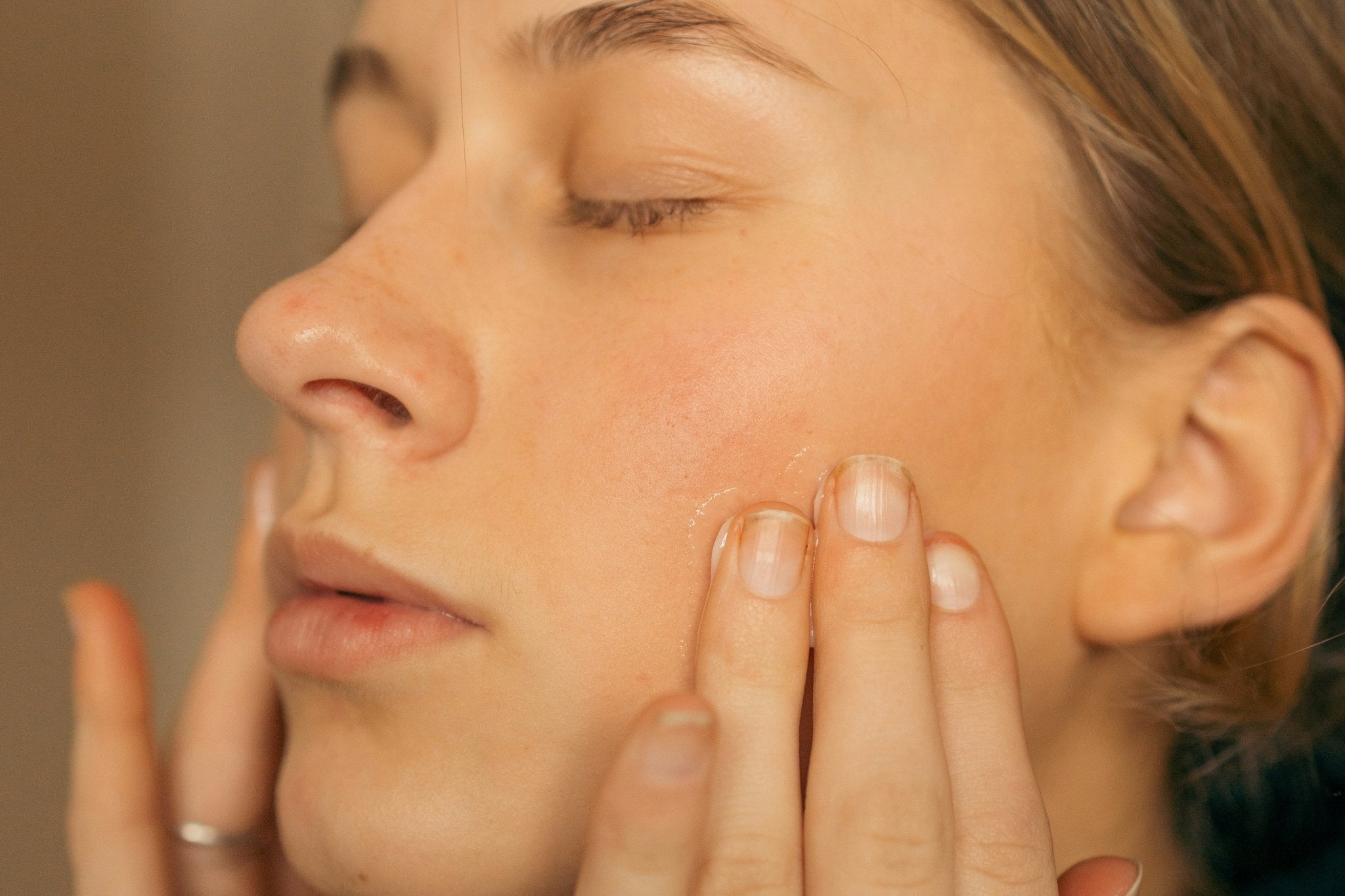 5 Mistakes People Make When Treating Sensitive Skin (and What to Do Instead) - Skynbio Skincare