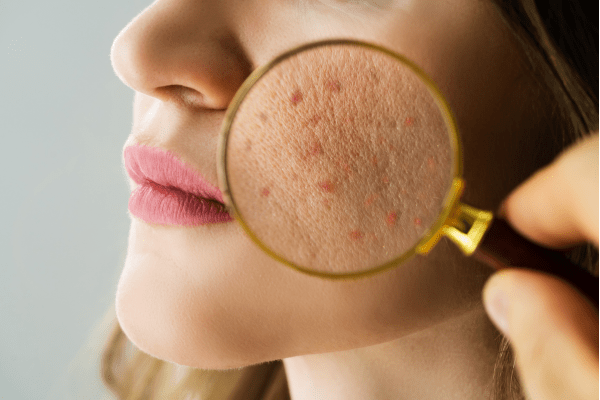 Barrier Repair 101 - Skynbio Skincare