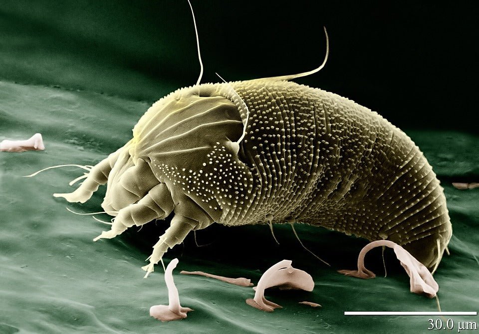 Demodex Mites, Yeast & Your Skin: How They Impact Your Fungal Acne Skincare Routine - Skynbio Skincare