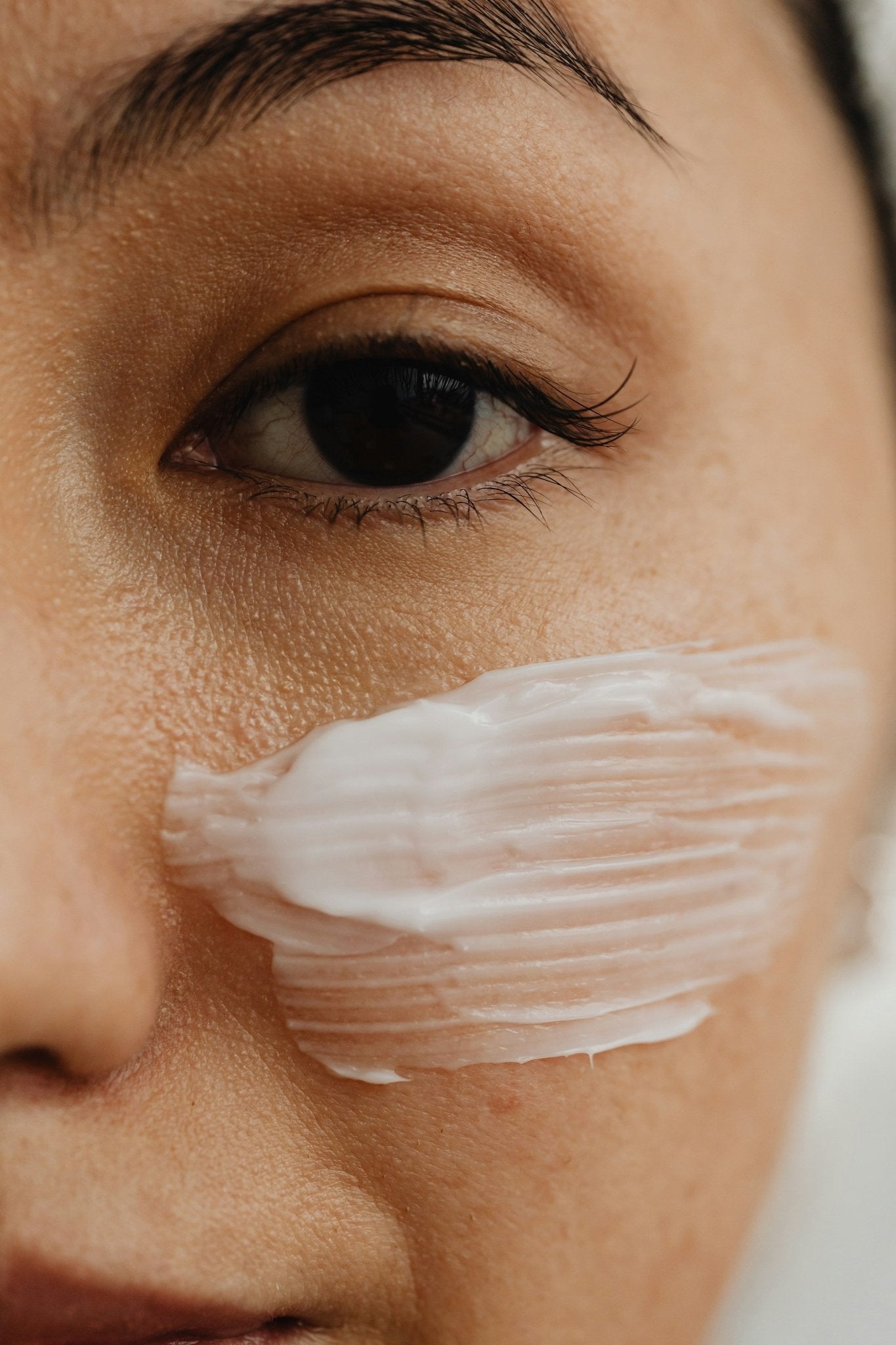 How Skynbio Supports Rosacea-Prone Skin - Skynbio Skincare