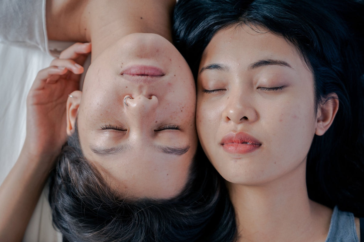 How to Help a Teen With Fungal Acne Without Frustration: A Parent's Guide to Fungal Acne Skincare - Skynbio Skincare