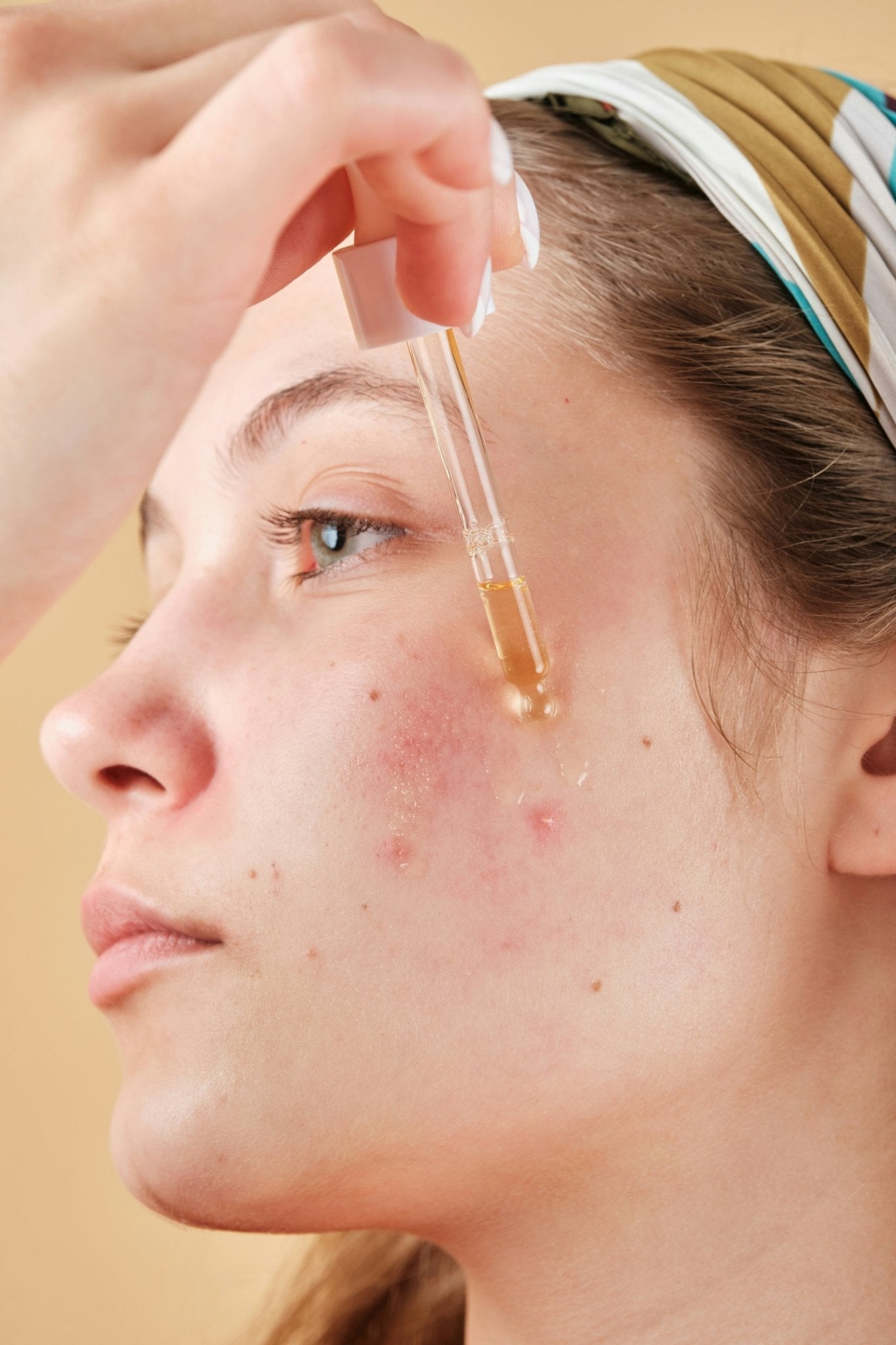 How to Layer Active Ingredients Safely: A Fungal Acne Skincare Guide - Skynbio Skincare