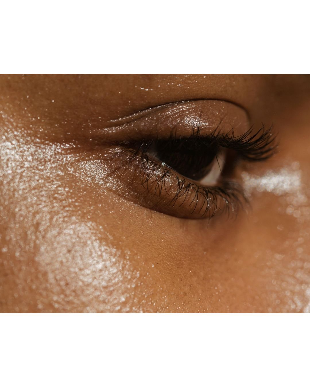 Why the Skynbio System Is Effective for Oily Skin - Skynbio Skincare